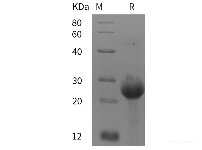 Recombinant Human ABL1/c-Abl  protein (His tag)