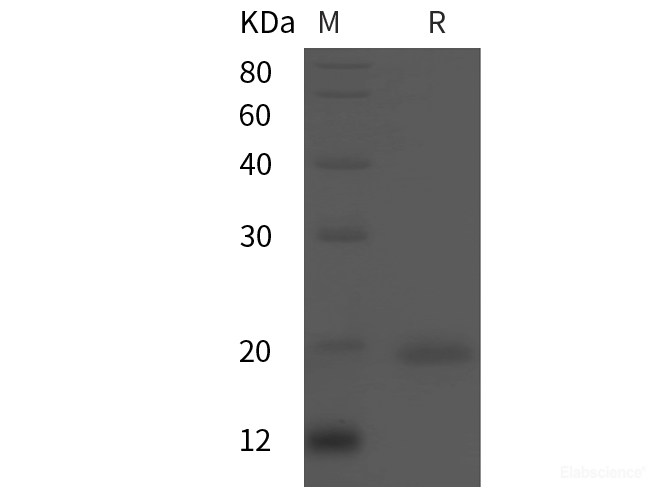 Recombinant Human PPAR-delta protein (His tag)
