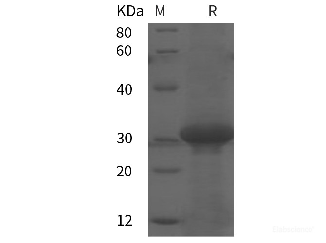 Recombinant Human KL protein (His tag)