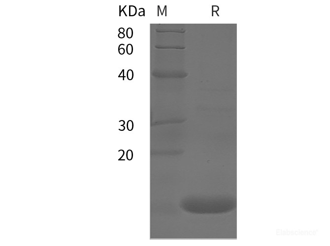 Recombinant Human TNFa protein (Avi, His tag)