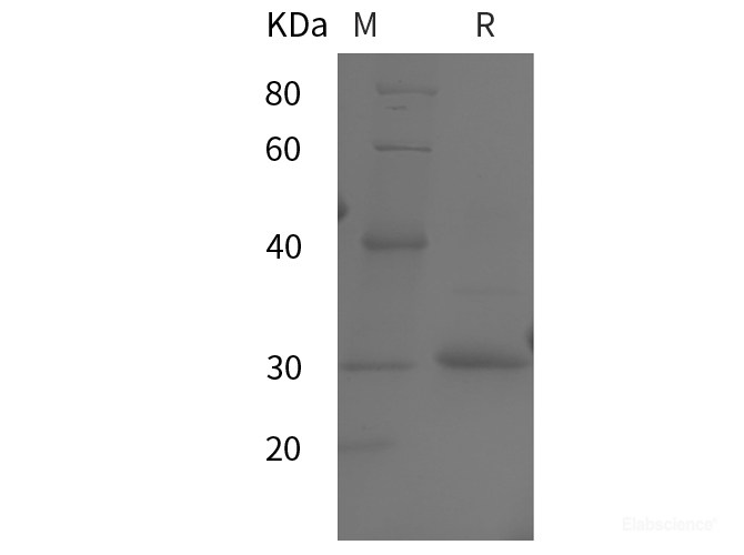Recombinant Human ER alpha protein (His tag)