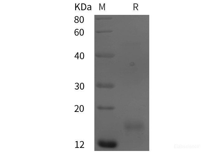 Recombinant Human TIMP3 protein (His tag)