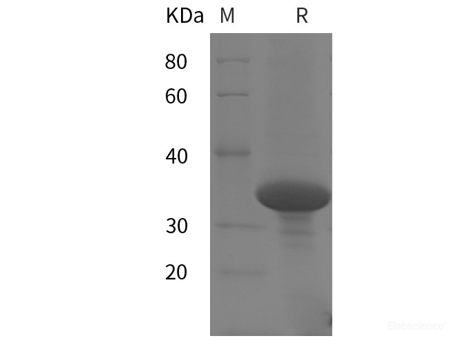 Recombinant Human HDAC1 protein (His tag)