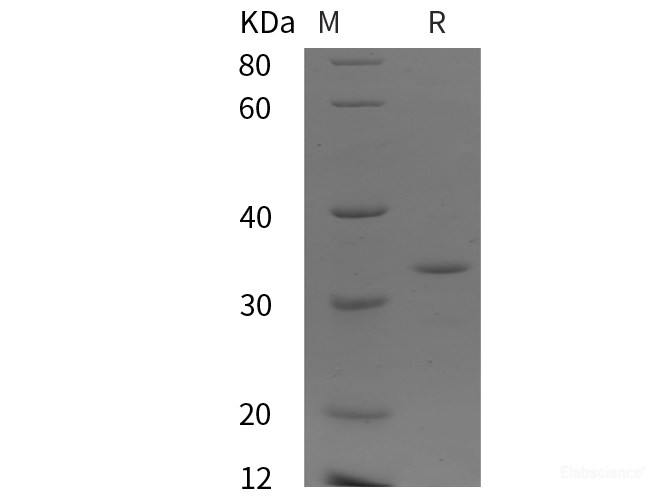 Recombinant Human CaSR protein (His tag)
