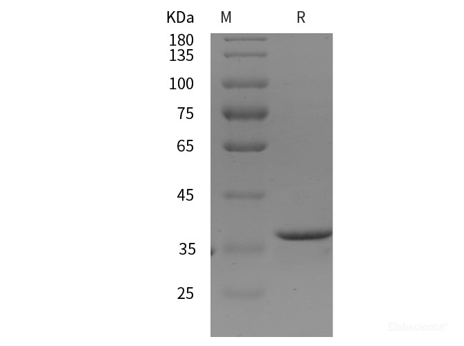 Recombinant Human MMP-2/CLG4A protein (His tag)