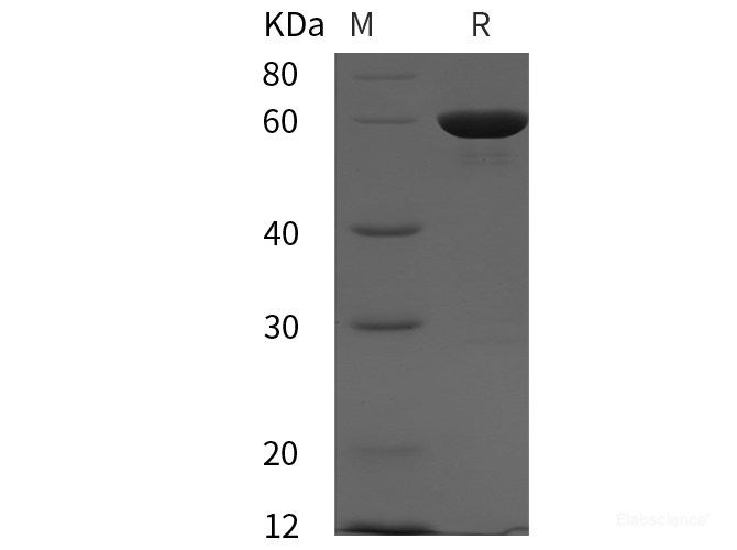 Recombinant Human PTPN11 protein (His tag)
