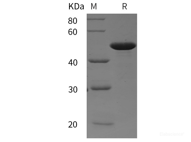 Recombinant Human FGFR3 protein (His tag)