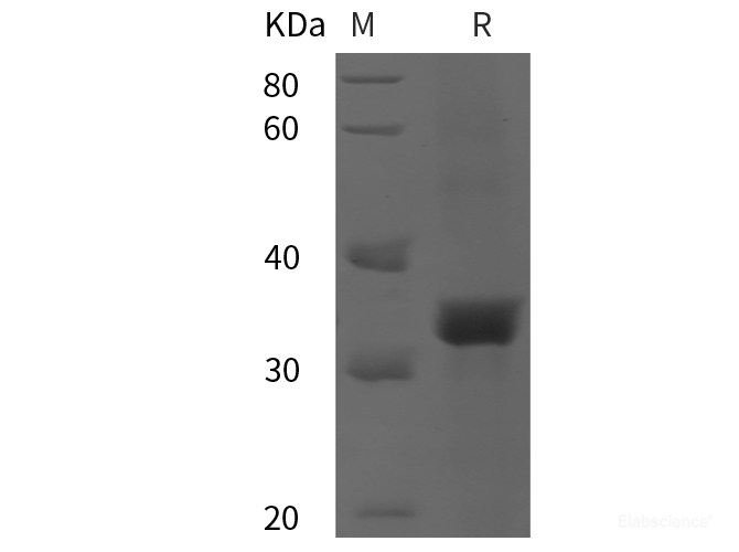 Recombinant Human MMP-9/CLG4B protein (His tag)