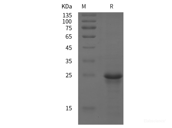 Recombinant Human CD147/BSG/Basigin protein (His tag)