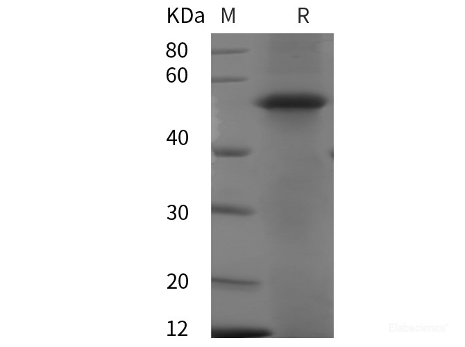 Recombinant Human XIAP protein (His tag)