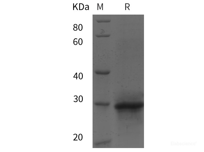 Recombinant Human Ras-related protein Rab-14／RAB14 protein (His tag)