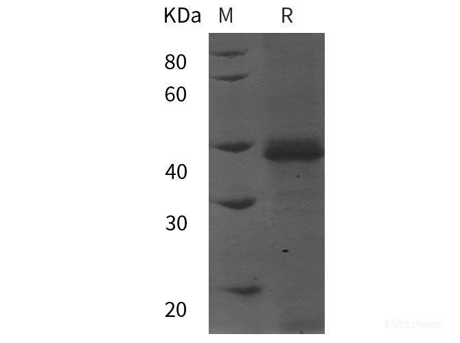 Recombinant Human PP2A-Cα/PPP2CA protein (His tag)