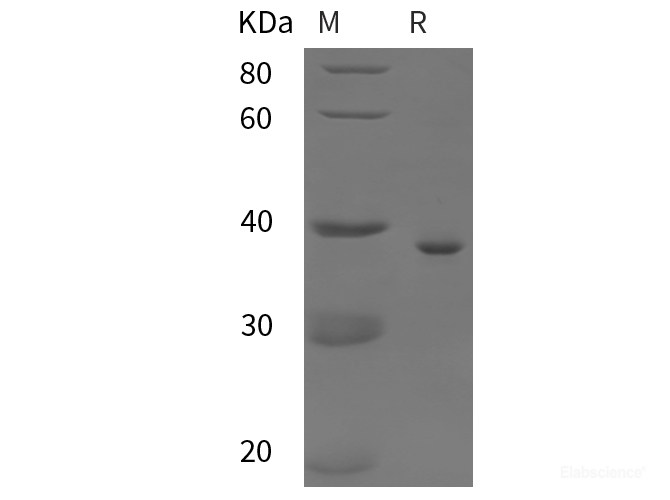Recombinant Human Cytokein19 protein (His tag)
