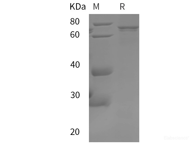 Recombinant Human AKT1 protein (SUMO,His tag)