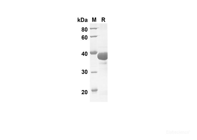 Recombinant Human IL17D Protein(Sumo Tag)-Elabscience