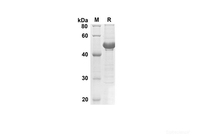 Recombinant Human CDH1  Protein(Sumo Tag)-Elabscience