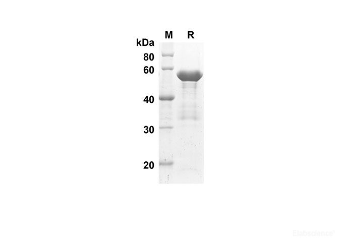 Recombinant Human ACE2 Protein(Sumo Tag)-Elabscience