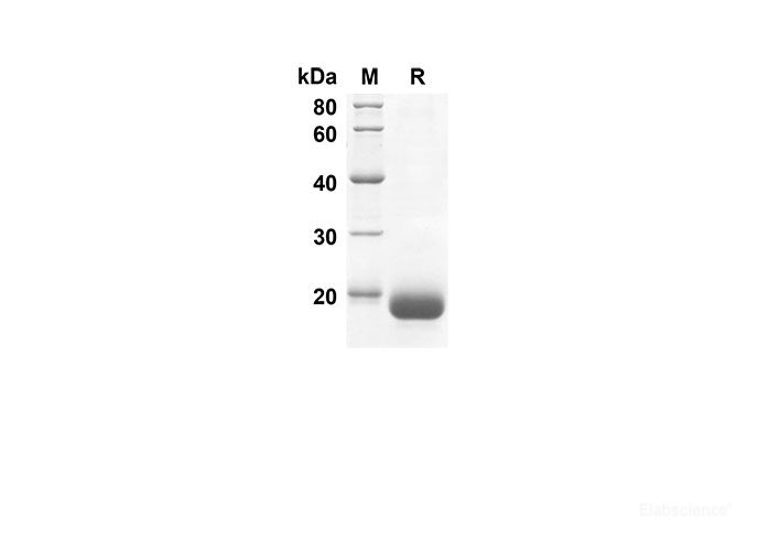 Recombinant Human DEFB1 Protein(Sumo Tag)-Elabscience