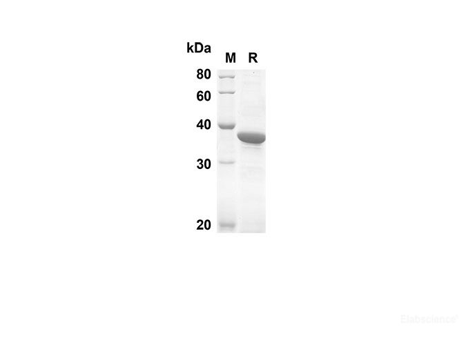 Recombinant Human MLKL Protein(Sumo Tag)-Elabscience