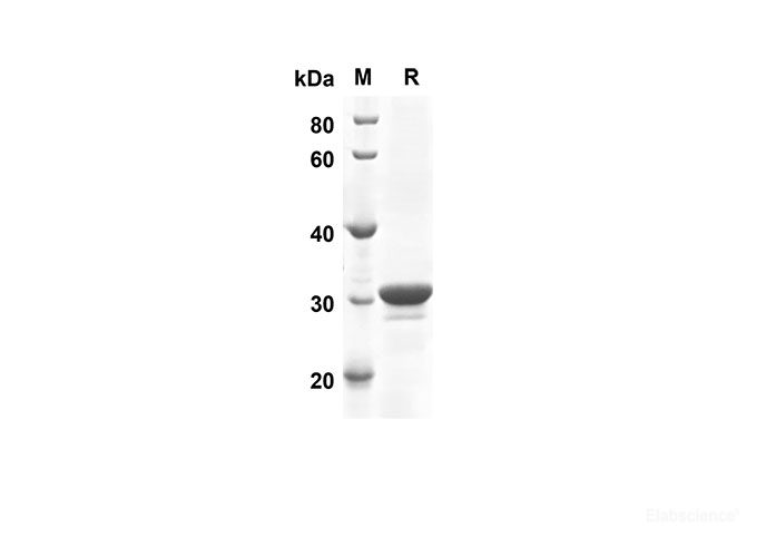 Recombinant Human MAP1LC3B Protein(Sumo Tag)-Elabscience