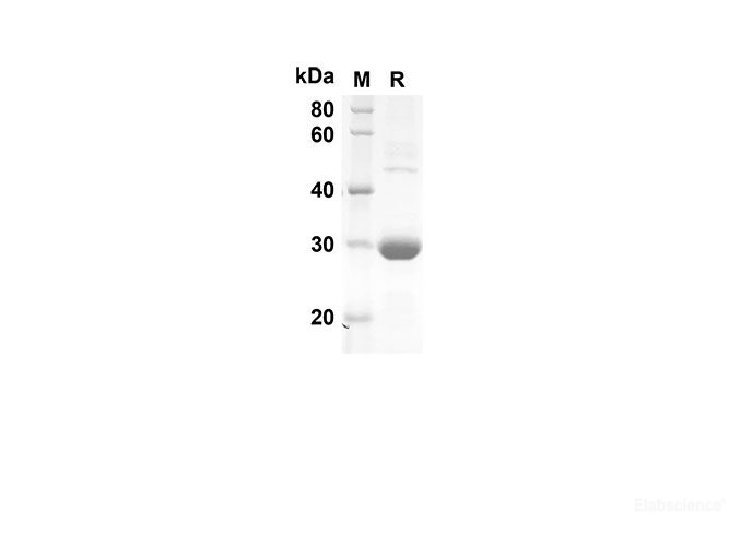 Recombinant Human CXCL5 Protein(Trx Tag)-Elabscience