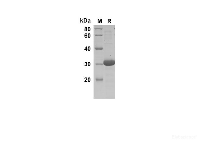 Recombinant Human CCL27 Protein(Trx Tag)-Elabscience