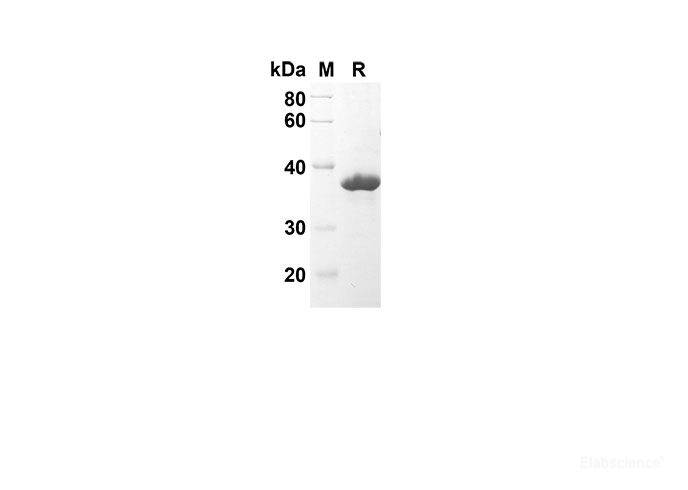 Recombinant Human CNTF Protein(Sumo Tag)-Elabscience
