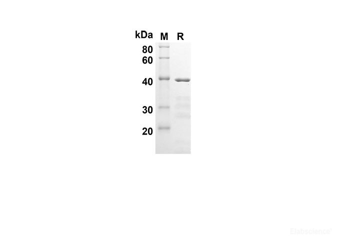 Recombinant Human BCL2 Protein(Trx Tag)-Elabscience