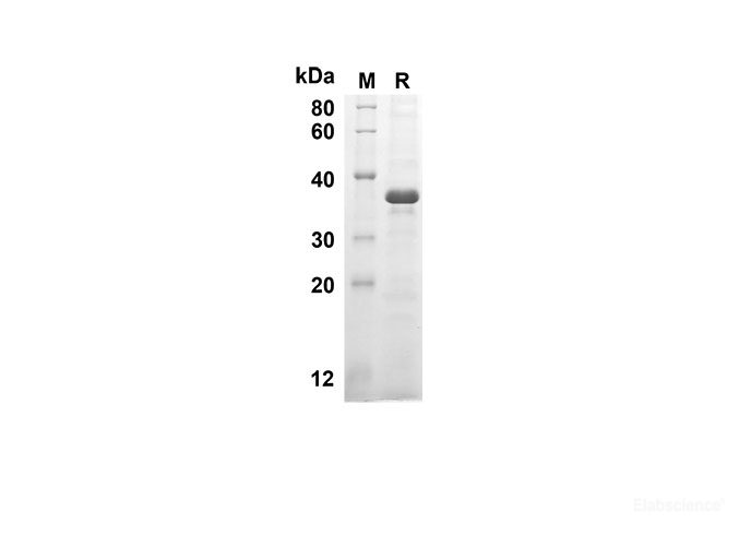 Recombinant Human CASP8 Protein(Sumo Tag)-Elabscience