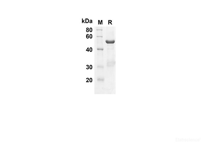 Recombinant Human CNTF Protein(Gst Tag)-Elabscience
