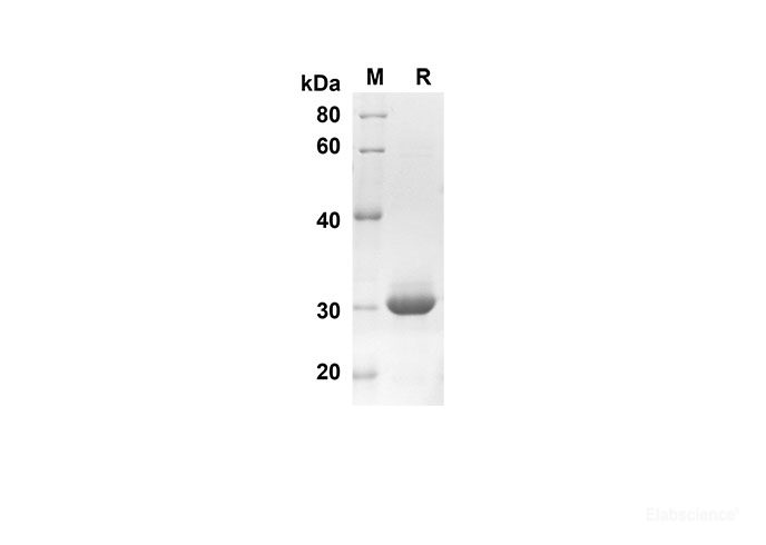 Recombinant Human S100A1 Protein(Trx Tag)-Elabscience