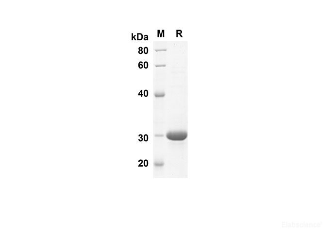 Recombinant Human S100A1 Protein(Sumo Tag)-Elabscience