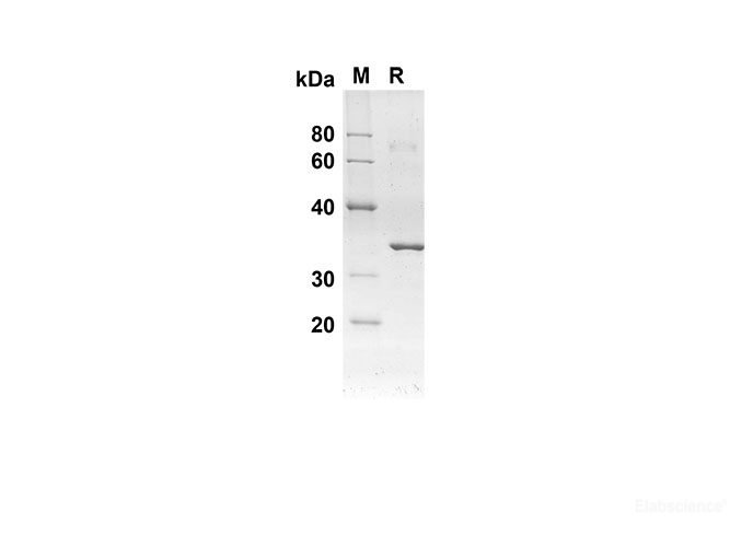 Recombinant Human CASP8 Protein(Trx Tag)-Elabscience