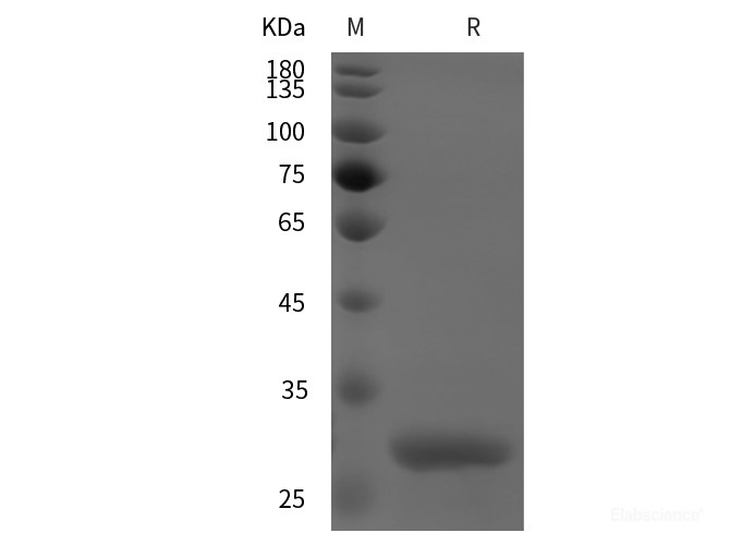 Recombinant Mouse INS protein (GST tag)