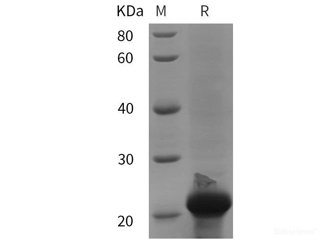 Recombinant Mouse CASP1 protein (His tag)