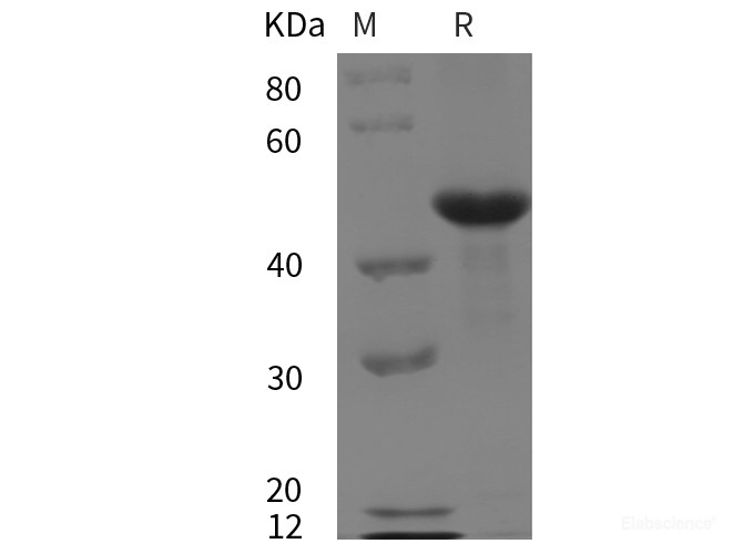 Recombinant Mouse MMP-9 protein (His tag)