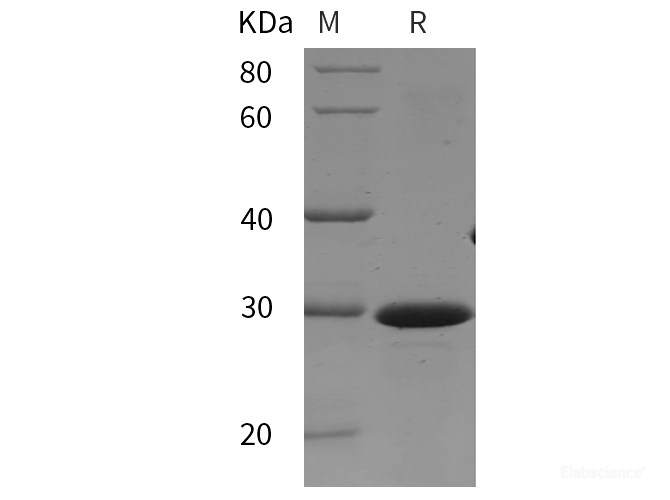 Recombinant Mouse FGFR3 protein (His tag)