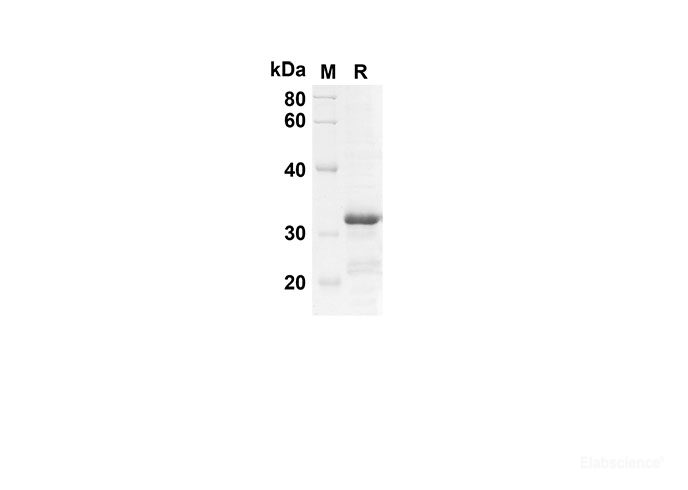 Recombinant Mouse Ccl22 Protein(TRX Tag)-Elabscience