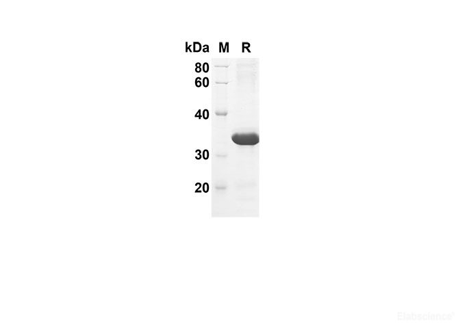 Recombinant Mouse Ccl21a Protein(Trx Tag)-Elabscience