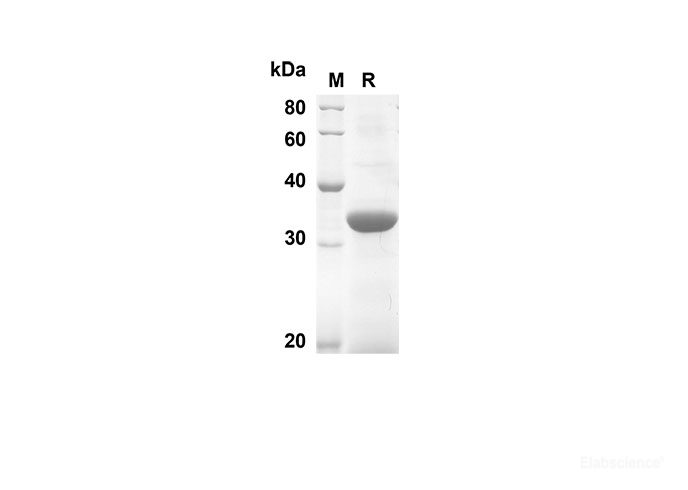 Recombinant Mouse IL-21 Protein(Sumo Tag)-Elabscience