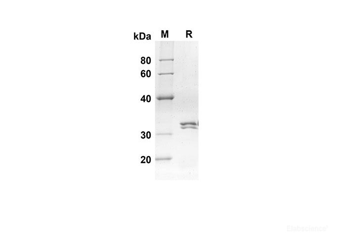 Recombinant Mouse Ccl24 Protein(Trx Tag)-Elabscience