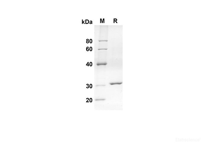 Recombinant Mouse Ccl8 Protein(Trx Tag)-Elabscience