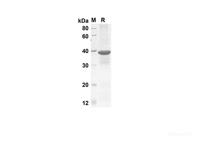 Recombinant Mouse CCL3 Protein(Gst Tag)-Elabscience