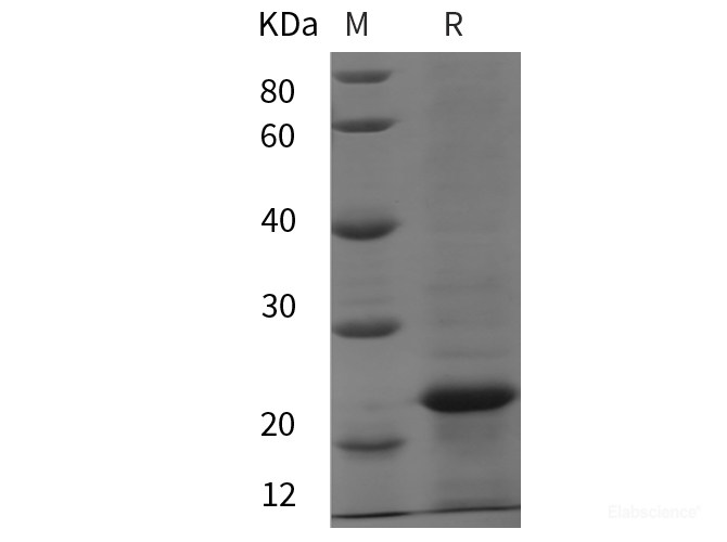 Recombinant Rat MMP-12 protein (His tag)