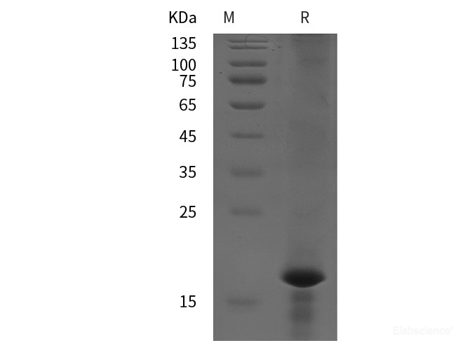 Recombinant Rat AIF-M1 protein (His tag)
