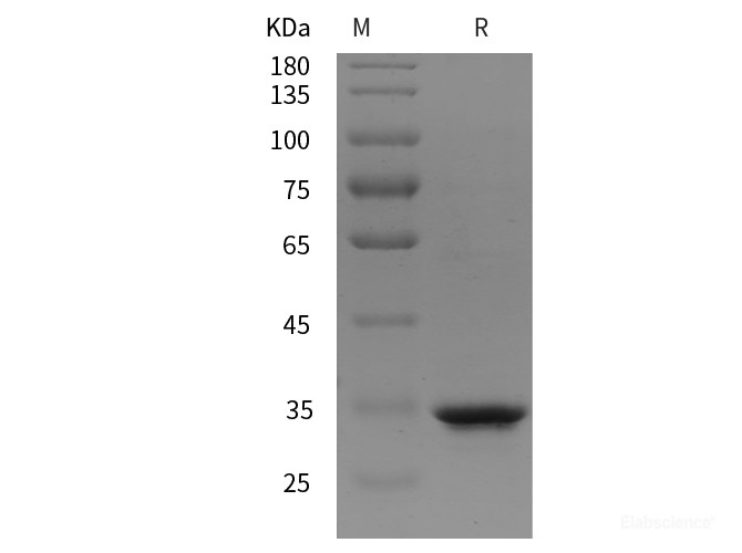 Recombinant Rat MMP-2/CLG4A protein (His tag)