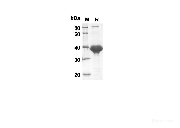 Recombinant Rat CNTF Protein(Trx Tag)-Elabscience