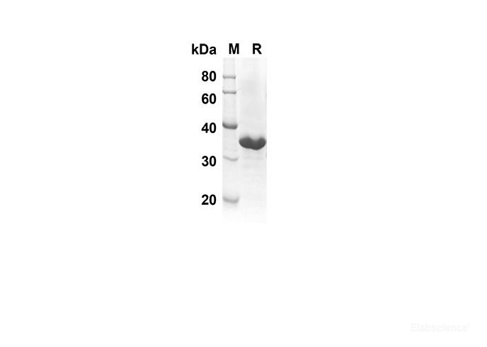 Recombinant Rat IL-21 Protein(Trx Tag)-Elabscience