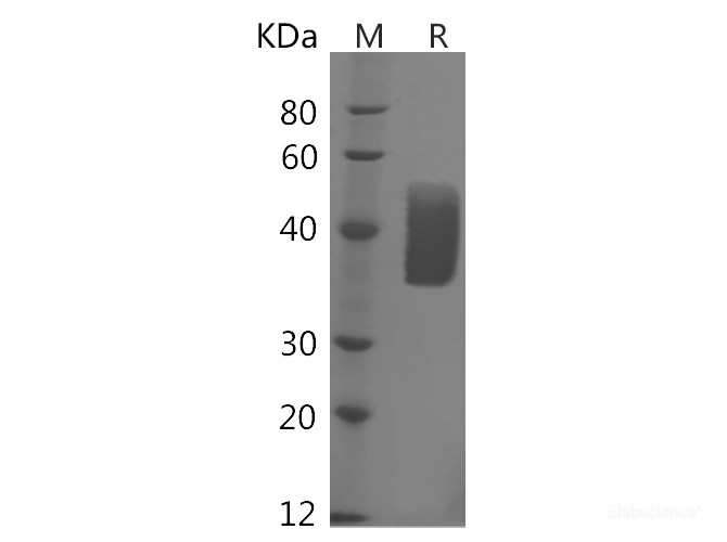 Recombinant Human KIR2DL1/CD158a Protein (His Tag)