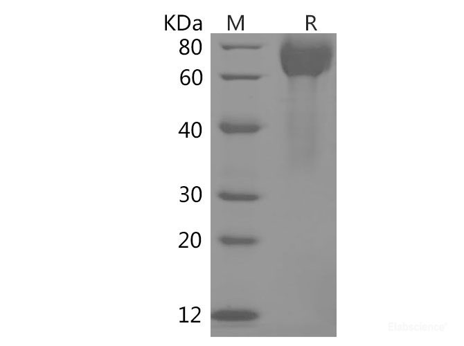 Recombinant Human B7-H3/CD276 Protein (His Tag)